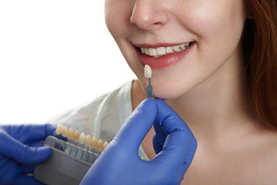 Unlock Your Perfect Smile with Spreckels Park Dental’s Cosmetic Dentistry